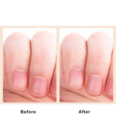 Mini Cuticle Trimmer Kit for Fingernails and Toenails - Nail Nipper Cutter, Polish Pusher, Peeler Scraper - Perfect for Hangnails (1 Pack) - Buy Online on GoSupps.com