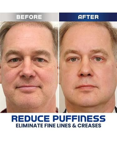 Himse Awaken Peptide Depuffing Eye Gel Reduces Puffiness Dark Circles Under Eye Bags Wrinkles and Fine Lines Around Eyes Moisturizing Eye Cream for Men (1 Pcs) - Buy Online on GoSupps.com