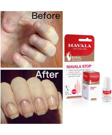 Mavala Stop Deterrent Nail Polish Treatment Stops Putting Fingers In Your Mouth For Ages 3+ 5 ml (Pack of 1) - Buy Online on GoSupps.com