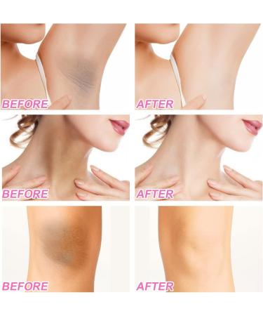 Cream Aclaradora Para Piel Manchas En Cara Axilas Cuello Entrepierna 100ml Crema Para Aclarar Las Axilas Y Partes Intimas Blanqueadora Para Partes Intimas - Buy Online on GoSupps.com