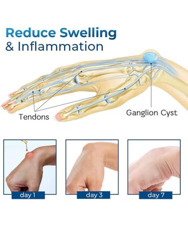 German Wrist Tendonitis Therapy Oil German Anti Paronychia Relief Oil Holistics Muscle Relief Massage Oil Massaging Joint & Muscles (3 pcs) - Buy Online on GoSupps.com