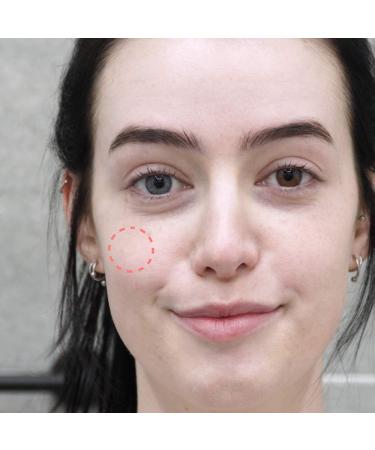 PURITO All Care Recovery Cica-Aid 51 Patches - Pack of 2 Hydrocolloid Acne Pimple Spot Treatment Dots - Centella Invisible Absorbing Cover - Buy Online on GoSupps.com