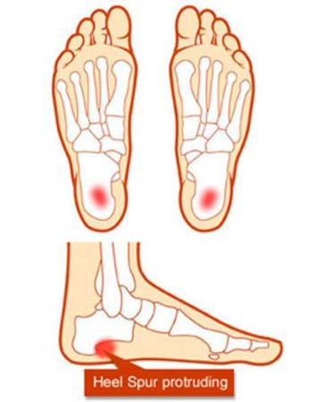 Pedag 190 Point Heel Spur Latex Cushion - White Leather - Large (Men's 7-9) - Buy Online on GoSupps.com