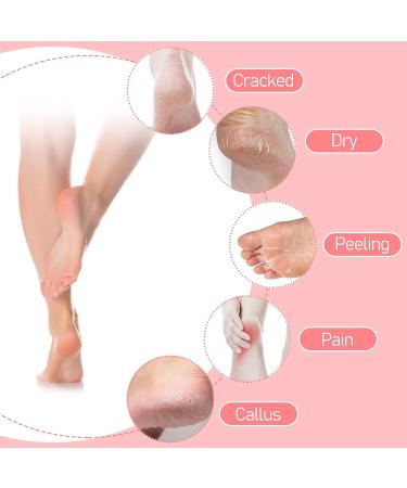 Sibba Gel Heel Socks - Moisturizing Treatment for Cracked Heels | Open Toe Day/Night Care for Soft, Beautiful Skin - Pink (2 Pairs) - Buy Online on GoSupps.com