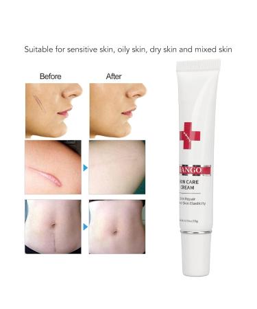 Nourishing Plant Based Scar Cream for Safe & Gentle Scar Repair - Buy Online on GoSupps.com
