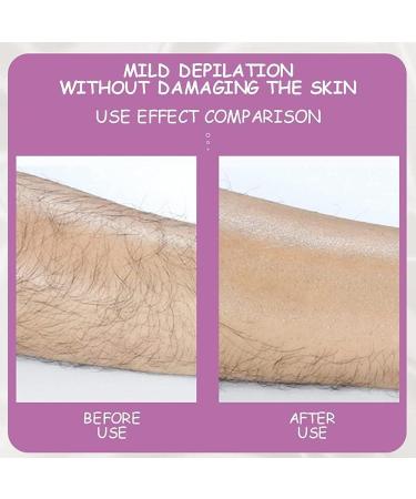 Crystal Hair-Wheeling Rubber - Magical Nano-Crystal Hair Remover for Men & Women | Fast & Easy Body Hair Removal Tool in Royal Blue - Buy Online on GoSupps.com