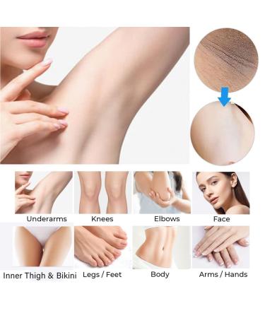 REMEDEN Intimate Area Dark Spot Remover Cream - Underarm, Armpit, Knees, Elbows, Inner Thigh - Corrector for All Skin Types - Buy Online on GoSupps.com