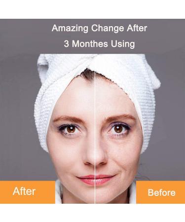 Golden 3D Electric Face Massager Roller | T Shape Facial Roller Kit - Buy Online on GoSupps.com