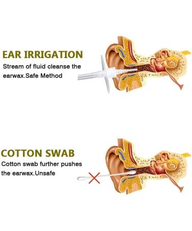 Ear Wax Removal Tool Kit - Elephant Ear Washer Bottle with 5 Disposable Tips for Adults & Kids (300ML) - Ear Irrigation Kit for Safe and Easy Ear Cleaning - 1 Count - Buy Online on GoSupps.com