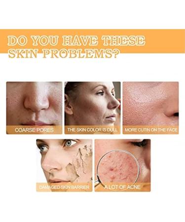 Glycolic Acid 7% Toning Resurfacing Solution -Glycolic Acid 7% Toning Resurfacing Solution for Blemishes and Acne Anti-Aging Freckle Removal Acne Tighten Pores 1bottle - Buy Online on GoSupps.com
