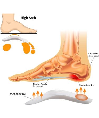 3/4 Arch Support Orthotics for Plantar Fasciitis Relief - Metatarsal Insoles for Over-Pronation Foot Pain & Morton s Neuroma - For Men Size 9-12 & Women Size 11-14 - Buy Online on GoSupps.com