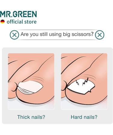 MR.GREEN Toenail Clipper Stainless Steel Ingrown Nail Cutter Good at Cutting Thick and Hard Nails Pedicure Tools (Black) - Buy Online on GoSupps.com