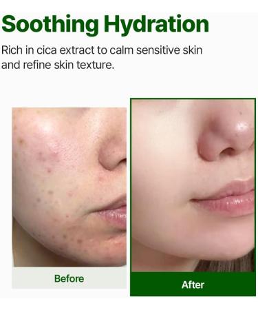 NACIFIC CICA PDRN First Toner 5.07 fl oz 150ml Centella Asiatica & PDRN for Sensitive Skin Cooling Spot Toner Balancing & Soothing Korean Skincare - Buy Online on GoSupps.com