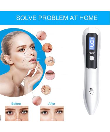 WART & Skin Tag Removal Kit for Women - Model 40226 - Buy Online on GoSupps.com