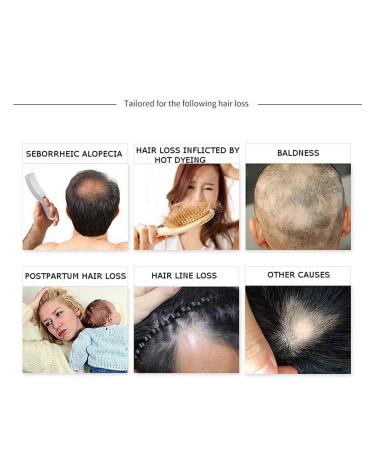 DISAAR BEAUTY Hair Growth Essential Oil 30g - Natural Plant Dry Growth Essence for Anti Hair Loss and Scalp Treatments with Genseng for Dense Hair - Buy Online on GoSupps.com