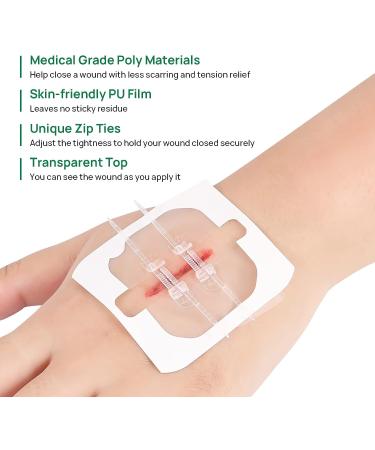 5pcs Zip Stitch Suture Free Wound Closure Strips | Butterfly Bandages for Emergency Laceration Repair - First Aid Kit Essential - Buy Online on GoSupps.com