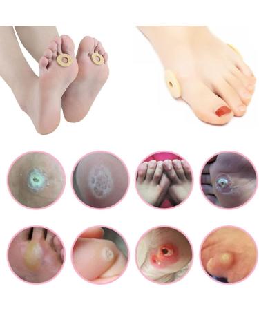 60PCS Corn Remover Plasters - Self-Adhesive Toe Pads for Pain Relief, Overnight Corn Removal, Waterproof Foot Protectors - Buy Online on GoSupps.com