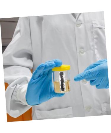 Urine Temp Strips 25pcs | Fish Tank Test Strips | Urinalysis Sticker - Buy Online on GoSupps.com