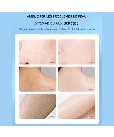 Cracked Heel Cream | 100g Softening & Repairing Ointment - Cracked Heel Cream Quickly Softens Hard Skin Prevents Recurrent Dryness For Feet - Buy Online on GoSupps.com