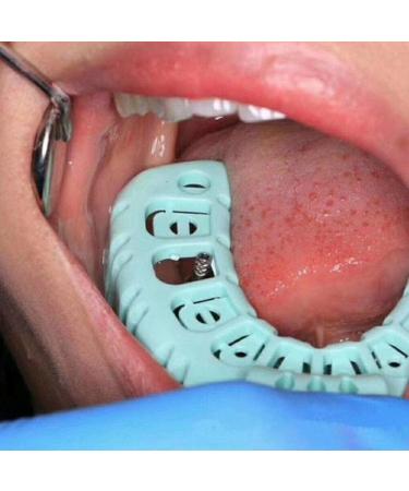 Baokuan Dental Counter - Precision Equipment for Accurate Measurements | International Shipping Available - Buy Online on GoSupps.com