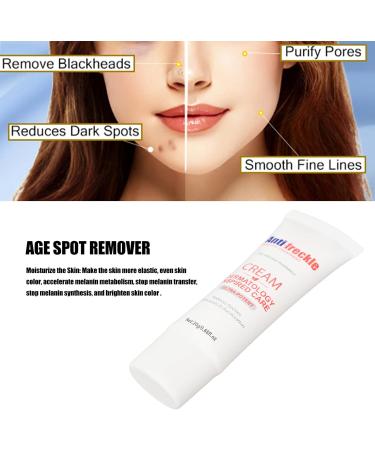 Face Freckle Removal Cream 0.7oz Nicotinamide Freckle Removal Cream Face Brightening Hydrating Nourishing Repairing Freckle Cream - Buy Online on GoSupps.com