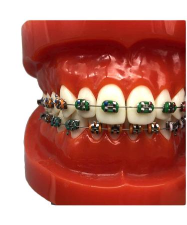 Orthodontic Teeth Model Dental Typodont With Mental Brackets Orthodontic Teeth With Ligature Ties Red