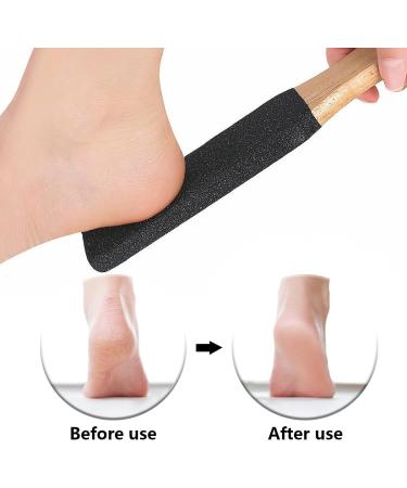 Foot File Foot Scrubber Dead Skin Remover Foot Callus Remover with Wooden Handle for Removes Hard Dead Skin Dry Calluses Rough and Cracked Corn Feet (Black) - Buy Online on GoSupps.com