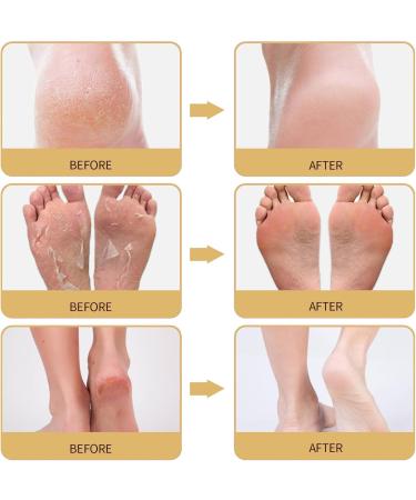 Anti-Crack Foot Creams Foot Creams Anti-Crack Heel Cream Natural Foot Soothing Cream Anti-Dryness Crack Cream Anti Freezing Dry Cracks And Cracks Heal Ointment - Buy Online on GoSupps.com