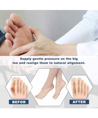 Bunions Splint Socks | Bunions Corrector Pads Bunions Relief Sleeve Brace with Soft Gel Cushion Pad for Foot Hurt Relief Toe Separator Straightener for Overlapping Skin Color - Buy Online on GoSupps.com