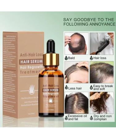UBIIKA Derma Roller 0.5mm + Hair Growth Serum Bundle | Anti Hair Loss, Thickening, Natural Herbal Essence | 540 Micro-needles - Buy Online on GoSupps.com