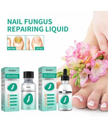 2Pcs Kerassentials Toenail Fungus Treatment - Healthy Skin, Hair & Nails Formula - Buy Online on GoSupps.com