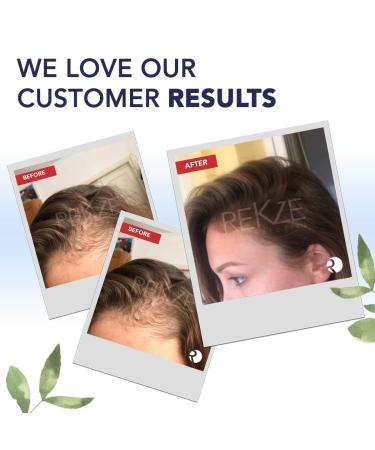 REKZE 24 Serum - Premium Hair Thickening & Anti-Hair Loss Treatment - Buy Online on GoSupps.com
