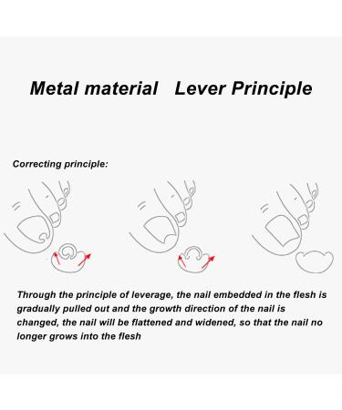 Saluaqui 10pcs Ingrown Toenail Corrector Toenail Correction Tool Toe Clamp Leverage Principle Alloy Ingrown Toenail Lifter for Pedicure Golden Silver - Buy Online on GoSupps.com