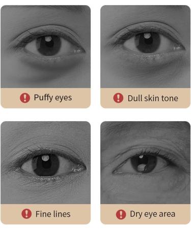 Caffeine Anti-Aging Eye Serum Eyozen Coffee Under Eye Serum Caffeine Eye Serum Under Eye Roller Cream for Dark Circles And Puffiness Retinol Anti-Wrinkle Eye Serum Oil (2pc) - Buy Online on GoSupps.com