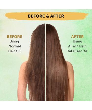 All-in-One Hair Vitaliser Oil for Root Scalp & Fiber Care - 200ml with Comb Applicator | Shop Internationally - Buy Online on GoSupps.com