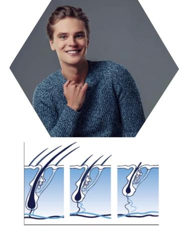 WT Methode PLACEN AS EXTRACTS 100 ml hair loss lotion + PRIOENERGY bioactive saw palmetto 250 ml shampoo - Buy Online on GoSupps.com