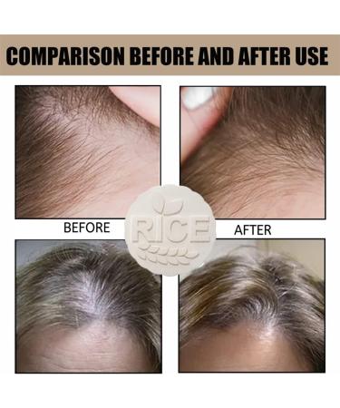 2in1 Rice Shampoo Bar Rice Shampoo Bars For Hair Growth Hair Loss Oil Control Shampoo Soap For Hair Growth Rice Water Shampoo And Conditioner For Hair Growth For Hair Growth (3 pcs) - Buy Online on GoSupps.com