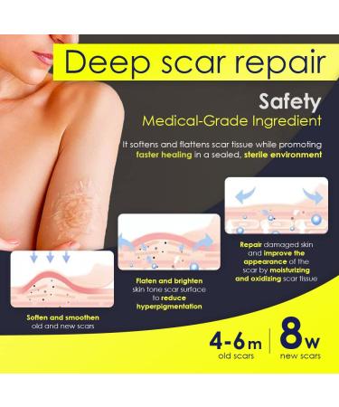 Professional Grade Silicone Scar Sheets 1.6x60 Inch - Medical Grade Silicone Scar Removal Tape for C-Section Surgery, Burns, Keloids - Healing & Treatment Strips - Pack of 1 - Buy Online on GoSupps.com