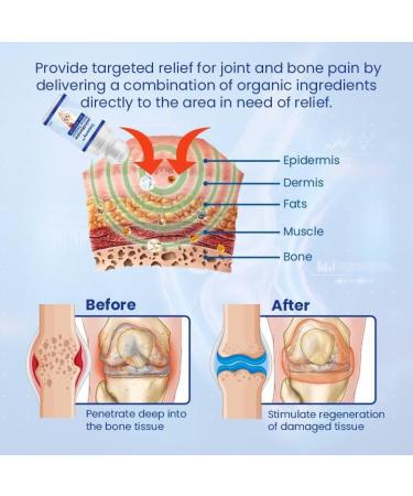 Jointrenew Bone Repair Gel Roller pour les douleurs articulaires et musculaires le dos le cou et les genoux - Buy Online on GoSupps.com