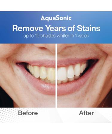 AquaSonic Power Bright Teeth Whitening Kit: Gel Syringes, LED Light, Whitening Pen - Fast & Safe Results - Buy Online on GoSupps.com