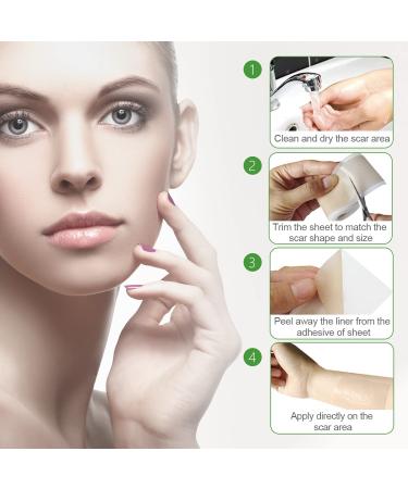Silicone Tape for Scars - Soft Medical Tape for Keloid, Surgical, Burn, and Acne Scars - Tummy Tuck Post Surgery Supplies - 1.6 x 120 Roll - Buy Online on GoSupps.com