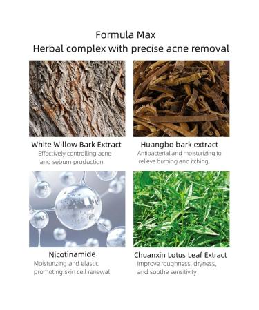 Buy Acne Removing Gel Online | Fast International Shipping & Best Results - Buy Online on GoSupps.com