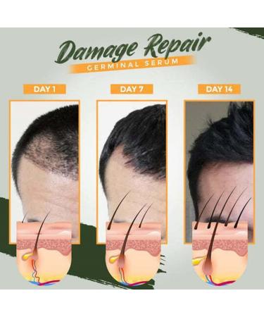 7 Day Herm Germinal Serum - Organic Hair Regrowth Kit | Accelerate Hair Growth & Prevent Hair Loss - Buy Online on GoSupps.com