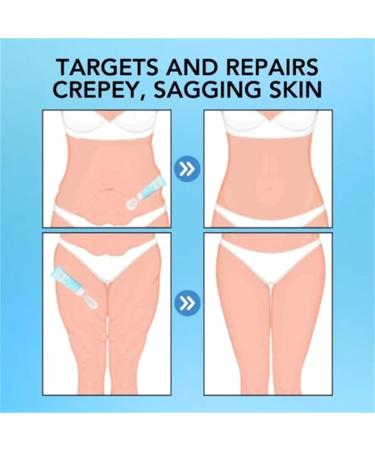 Luxelift Skin Firming Butter LuxeLift Body Firming Cream Skin Firming Cream Body Firming Butter Moisturizes Skin & Improves Fine Lines (1) - Buy Online on GoSupps.com