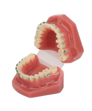 Orthodontic demonstration model orthodontic bracket model - can clearly represent the orthodontic process