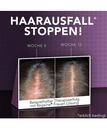 Regaine Women Foam with Minoxidil - 4-Month Pack for Stubborn Hereditary Hair Loss & Hair Growth - 2 x 60g - Buy Online on GoSupps.com