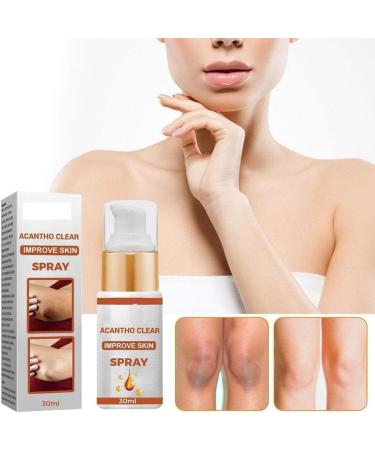 FOIDL Acantho Clear Therapy Spray - Acanthosis Nigricans & Dark Spot Remover - 30ml - Buy Online on GoSupps.com