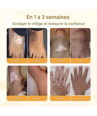 Lotion Pour Les Pieds Secs Lotions Pour Les Mains Extrait V g tal Nourrissant et claircissant pour Hydrater les Peaux S ches Sensibles - Buy Online on GoSupps.com