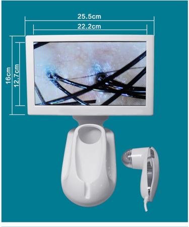 Skin Diagnosis Hair Analyzer 11 Inch Screen Scalp Hair Follicle Hair Skin Analyser Machine 200X Scalp Health Detection Instrument Health Detection for Skin Care Beauty Salon - Buy Online on GoSupps.com