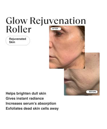 MATKAS Derma Roller + Cleaner Spray Kit - Microneedle Roller for Face, Hair, Scalp, Beard Growth - Dermaroller Microneedling Roller for Hair Regrowth and Skin Renewal - Buy Online on GoSupps.com